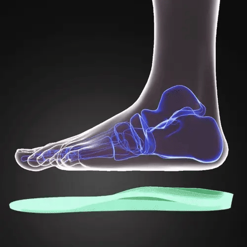 Support through the arch